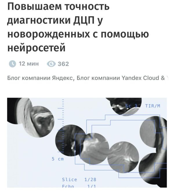 5218 Yandex Pristato Dirbtinį Intelektą Greitam Cerebrinio Paraly