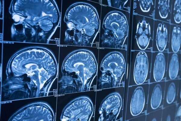 Neuraliniai Tinklai Prognozuoja Smegenų Reakcijas į Vaizdo įrašus