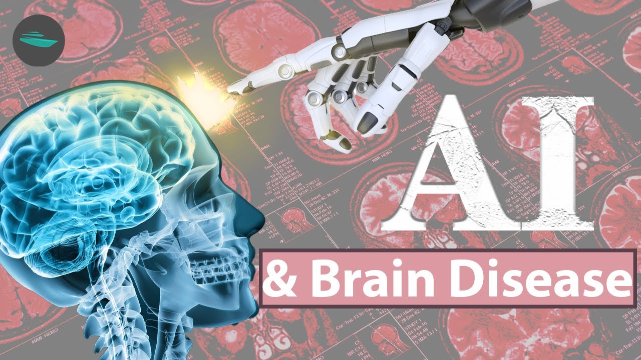 Rusijoje Sukurta Dirbtinio Intelekto Sistema Smegenų Ligų Diagnostikai