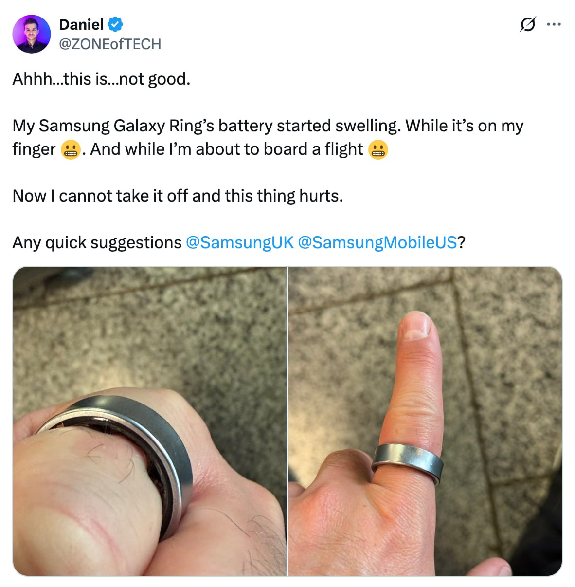 5501 Technologijų Pasaulio Iššūkiai Samsung Išmaniųjų žiedų Bate