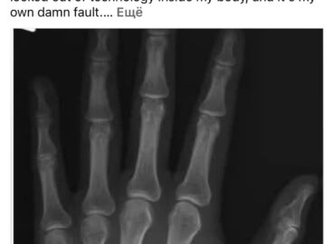 5952 Jaunuolis Iš Jav Pametė Rfidchipo Slaptažodį