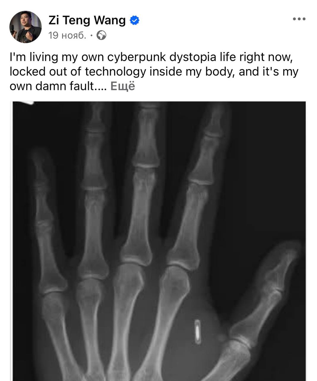 5952 Jaunuolis Iš Jav Pametė Rfidchipo Slaptažodį