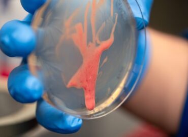 1670 Ralstonia Solanacearum Bakterija Sukelianti Augalų Infark