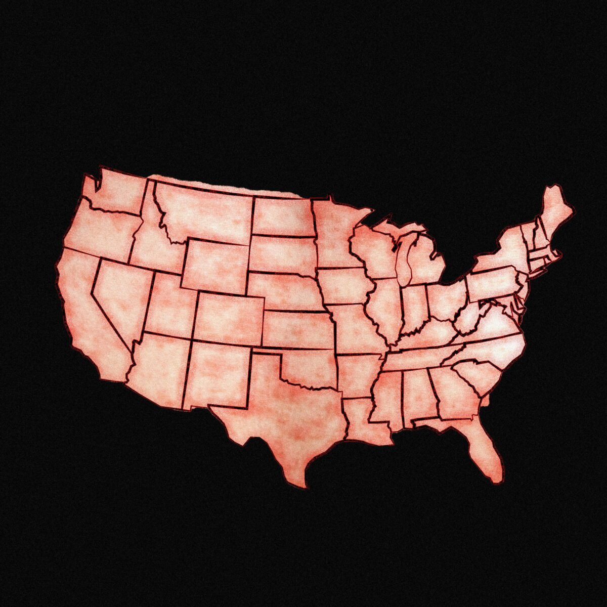 JAV susiduria su dar vienais sunkiais metais dėl tymų atvejų augimo