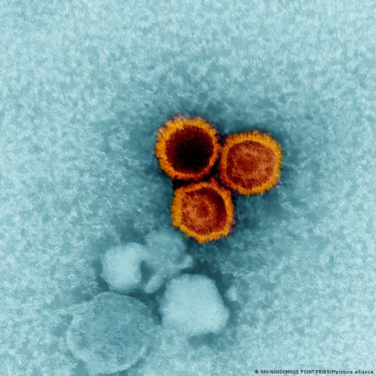 Epteino Baro Virusas Kaip Jis Sukelia Istin Skleroz