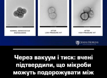 11056 Mokslininkai Patvirtino Kad Mikrobai Gali Keliauti Tarp Pla