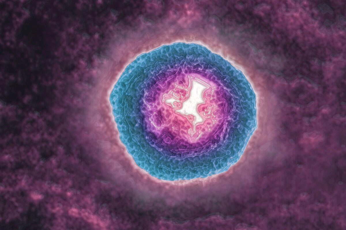 Juostinė pūslelinė gali spartinti senėjimą ir didinti demencijos riziką Juostin Pslelin Gali Spartinti Senjim Ir Didinti Demencijos Rizik