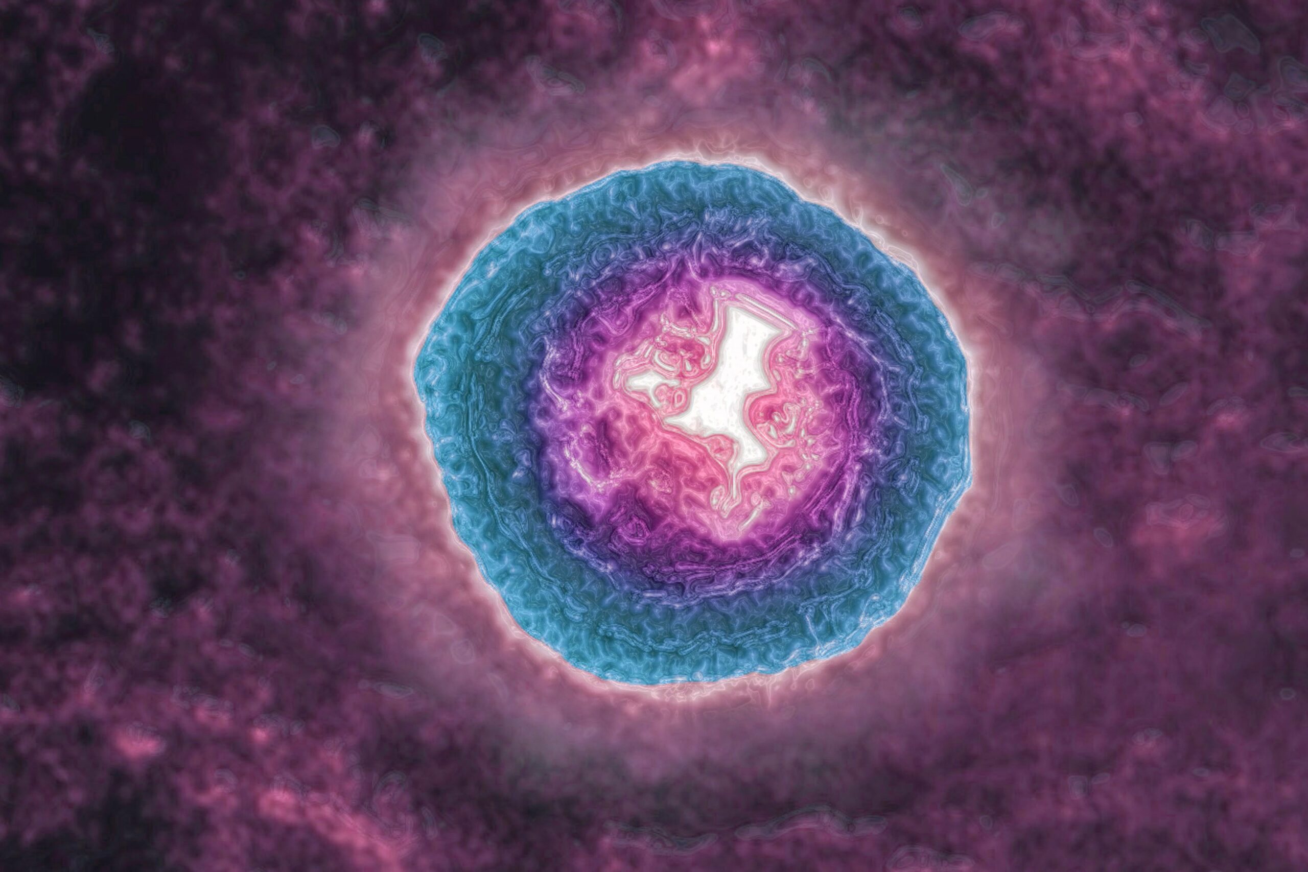 Juostin Pslelin Gali Spartinti Senjim Ir Didinti Demencijos Rizik