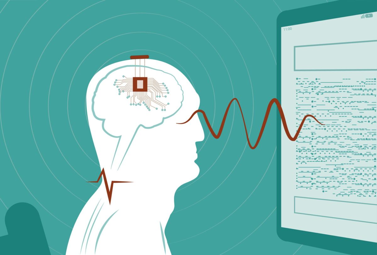 Kinija patvirtino pirmuosius smegenų implantus pardavimui ir siekia dominuoti rinkoje