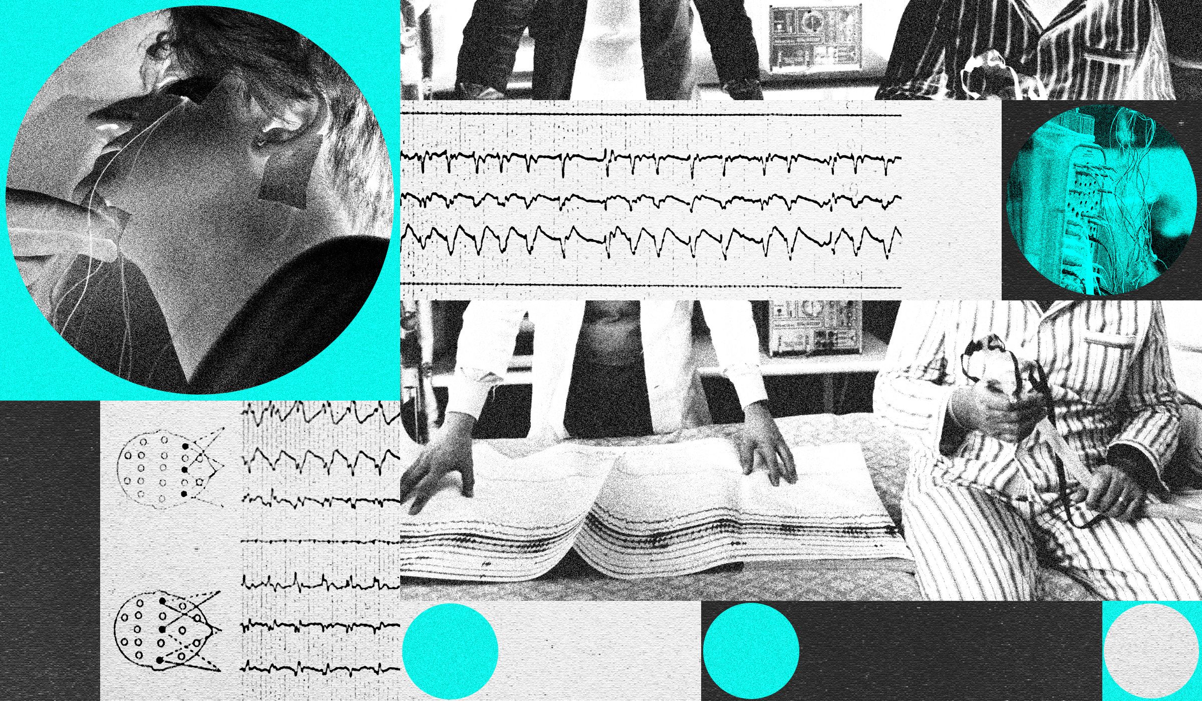 Technologijos Keiia Miego Apnjos Gydym Naujos Alternatyvos Cpap Aparatams