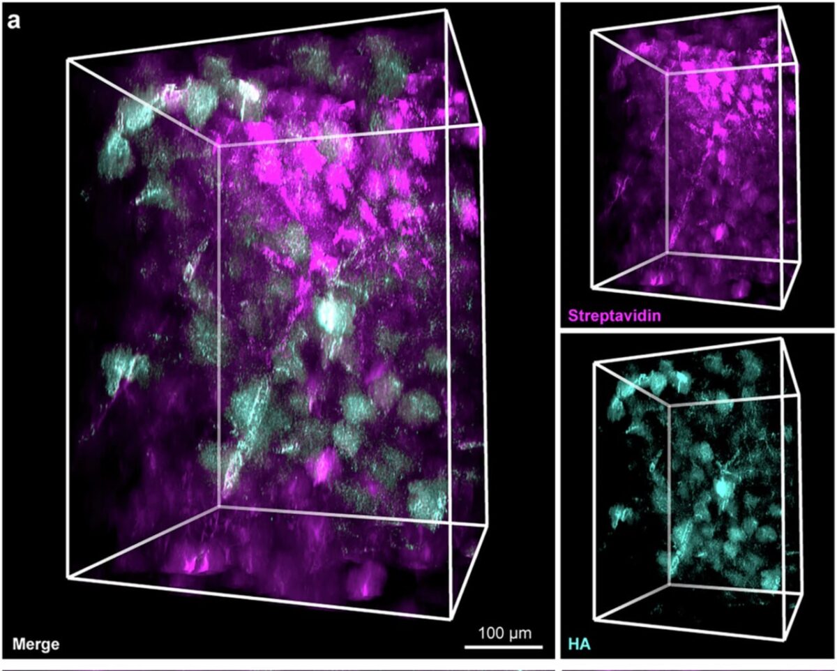 1913 Atrado Slaptą Smegenų Tinklą Astrocitų Vaidmuo Didesnis Nei