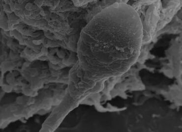 2364 Spermos Kelionė Kosmose Sunkumai Mikrogravitacijoje