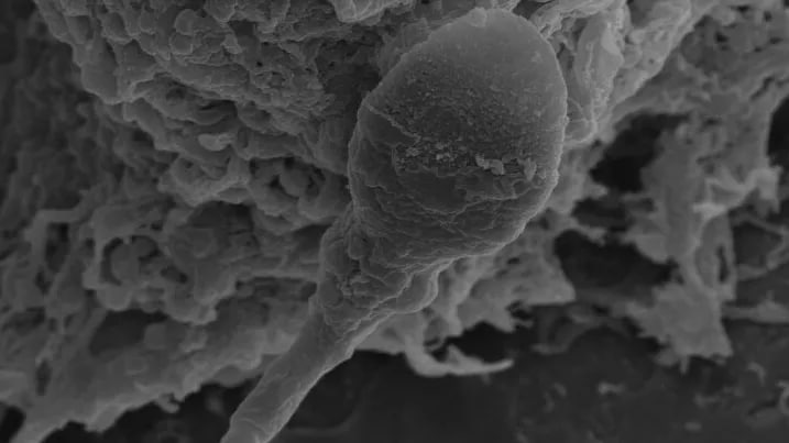 2364 Spermos Kelionė Kosmose Sunkumai Mikrogravitacijoje