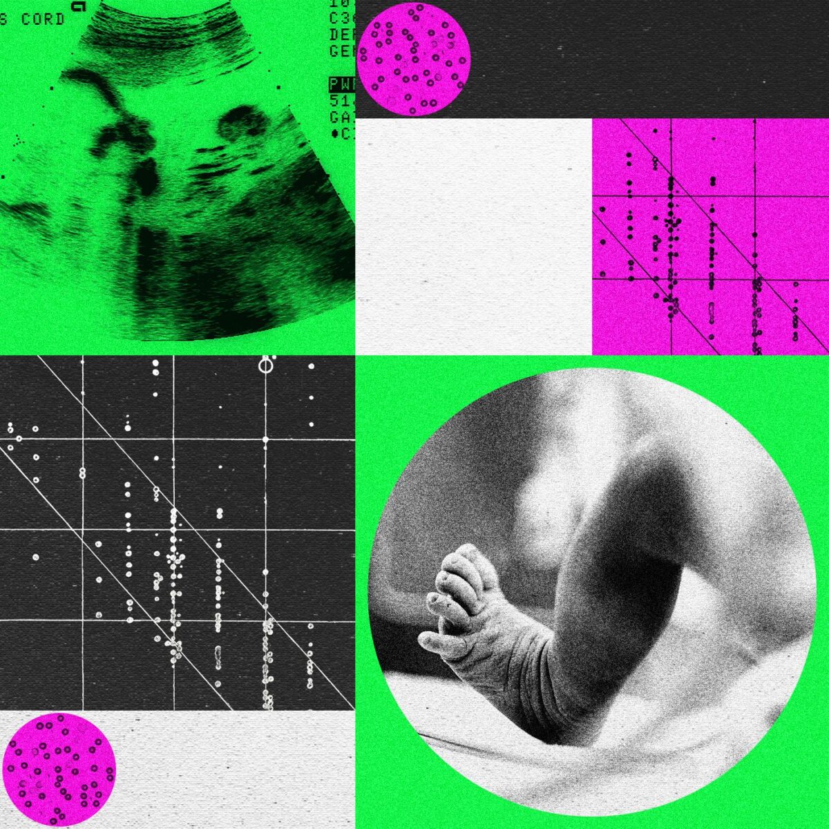 Gen Redagavimo Mons Susiduria Su Sunkumais Udaromos Bootstrap Bio Ir Manhattan Genomics