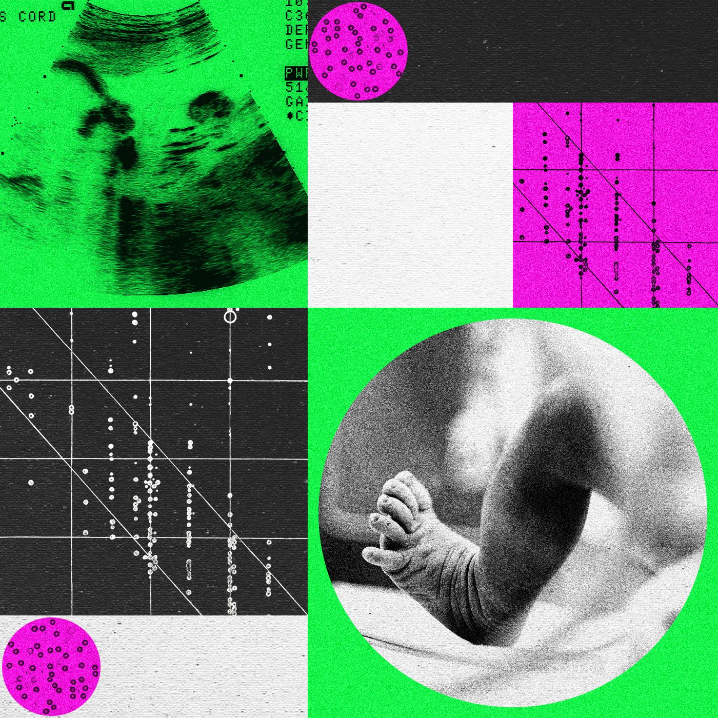 Gen Redagavimo Mons Susiduria Su Sunkumais Udaromos Bootstrap Bio Ir Manhattan Genomics