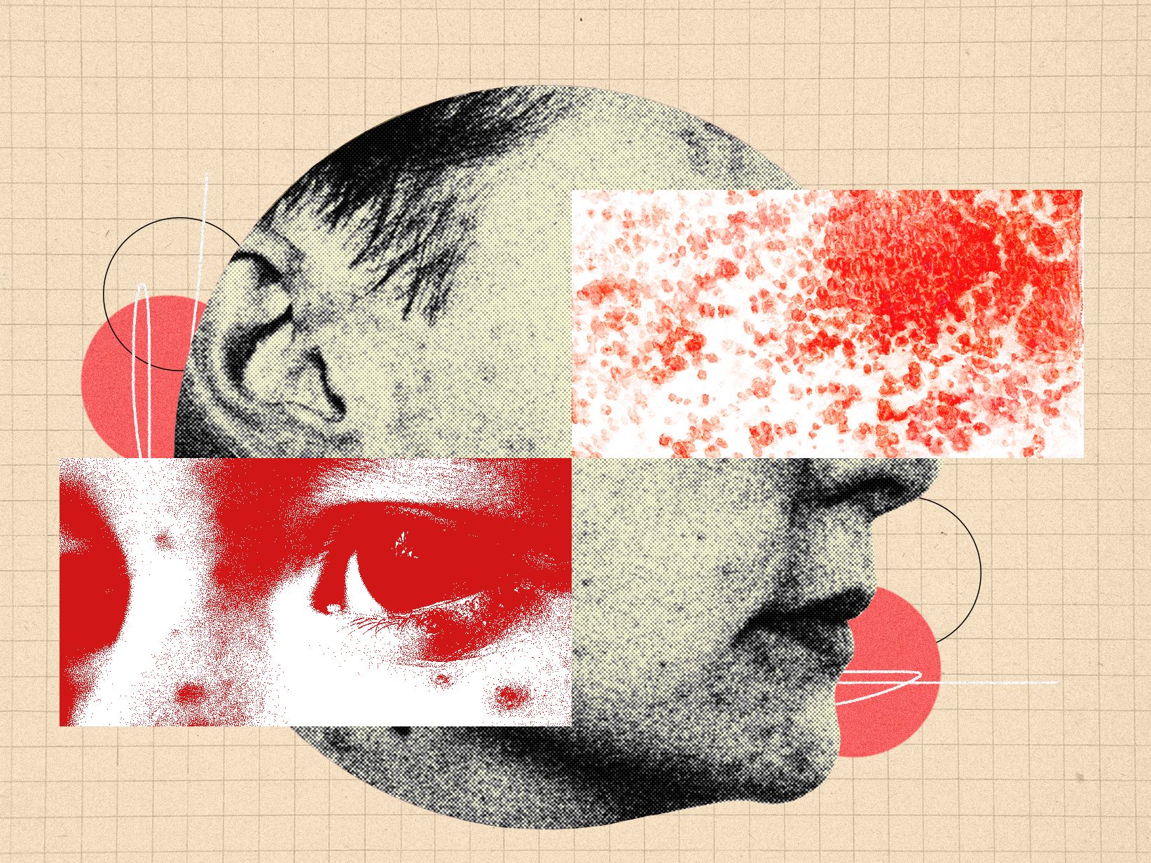 Juostin Pslelin Pavojai Ir Emos Skiepijimo Apimtys