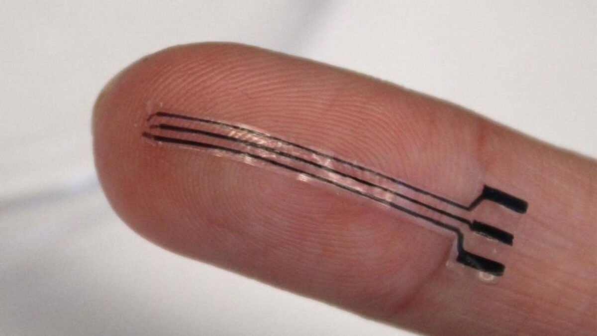 Naujas implantas gali sumažinti kraujo spaudimą be vaistų 1951 Naujas Implantas Gali Sumažinti Kraujo Spaudimą Be Vaistų