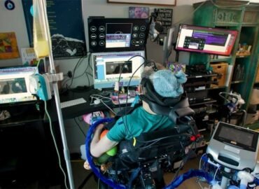 2028 Neurointerfeisas Padeda Als Sergančiam Vyrui Vėl Kalbėti