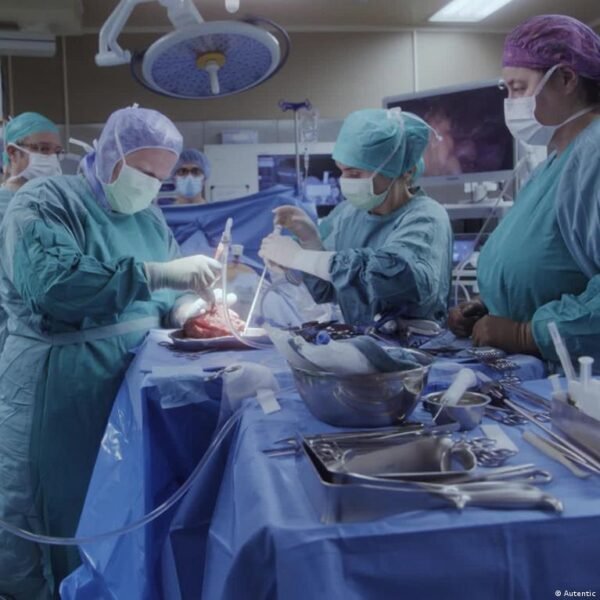 Vokietija Svarsto Galimyb Pereiti Prie Opt Out Organ Donorysts