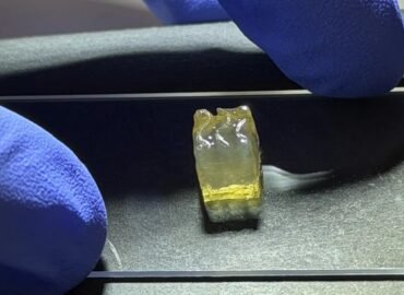 11657 Kosmose Pirmą Kartą Atspausdintos Inkstų Ir Kepenų Audiniai