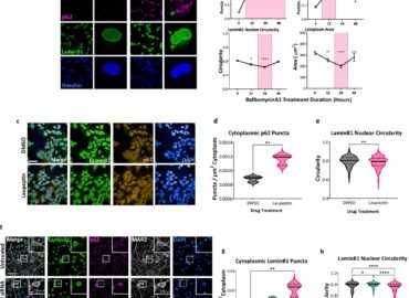 4279 Mokslininkai Atrado Naują Alzheimerio Ligos Poveikio Neurona