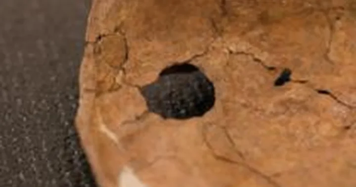 Shanidar urve rastame neandertaliečio skelete aptikta 15 milimetrų skylė mentėje