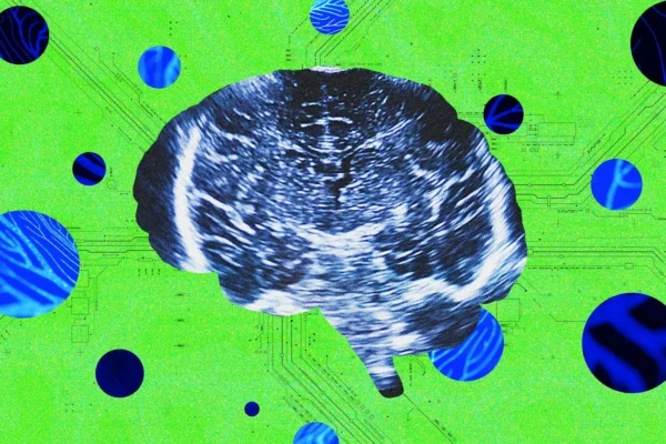 Bridge Neurotech pristatė planus kurti ultragarsu veikiantį nešiojamą smegenų ir kompiuterio sąsajos įrenginį